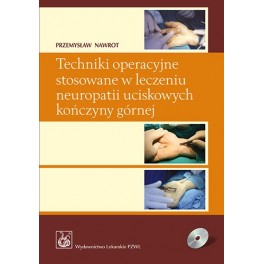 Techniki operacyjne stosowane w leczeniu neuropatii uciskowych kończyny górnej