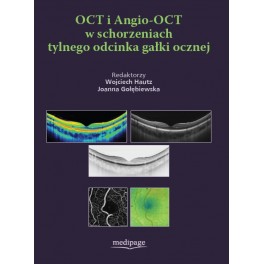 OCT i Angio-OCT w schorzeniach tylnego odcinka gałki ocznej