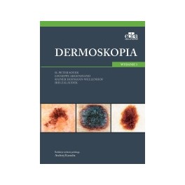 Dermoskopia